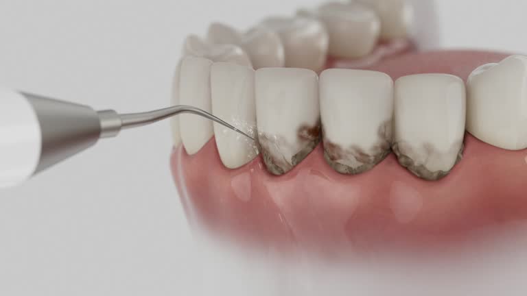 Trusted Teeth Cleaning And Checkup service in Maine, WI - Dentist Open Now